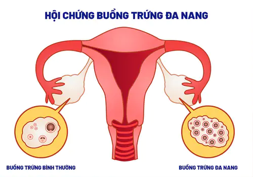 tong-quan-ve-hien-tuong-tre-kinh-o-nu-gioi-2.jpg